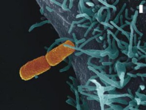 To je ona, bakterie Shigella Flexneri. Foto: Eurekalert.org