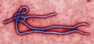 Virus ebola dokáže v těle mrtvého hostitele přežít až týden. Foto: Cdc.gov