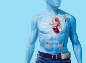 Nový typ umělého srdce bude využíván pro testování léků. Ilustrační foto: Wikipedia