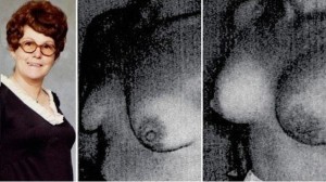 Timmie Jean Lindseyová byla první ženou, která si nechala dát silikonové implantáty. Zdroj: Esthé