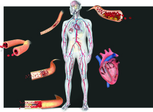 Grafické znázornění kardiovaskulárních onemocnění.
