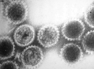 Geneticky upravený herpesvirus, který vyprovokuje útok imunitního systému na buňky nádoru, se stal historicky první terapií svého druhu, povolenou k použití v medicíně v USA. Foto: Wikipedia
