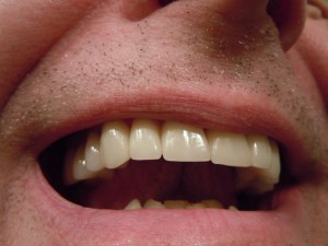  Než se dočkáme prvních zubních náhrad ničících bakterie, musí nový materiál také prokázat odolnost vůči působení zubní pasty a ústní vody. Ilustrační foto: Pixabay