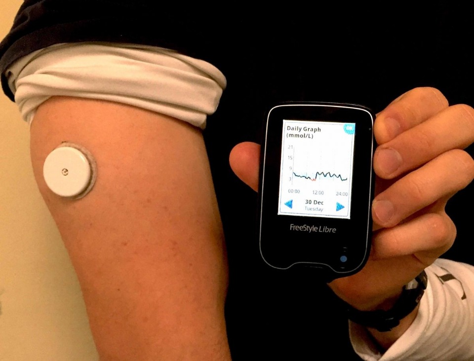 How Is Free Libra Glucose Monitor Installed